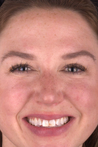 Patient before and after photos
