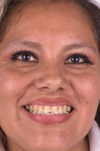 Patient before and after photos