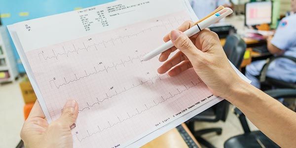 Hasil EKG