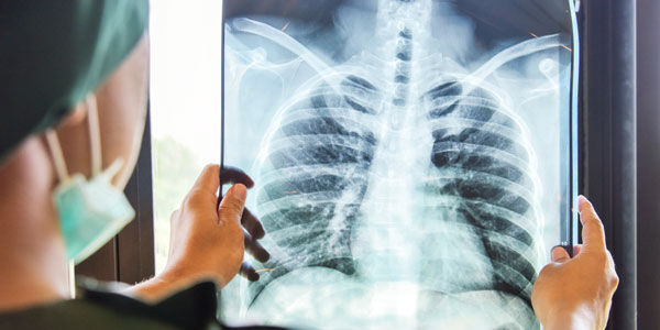 Rontgen Thorax