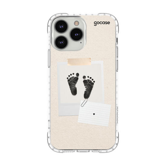 Capinha para celular  Pézinho do Bebê