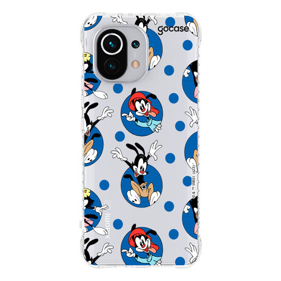 https://ik.imagekit.io/gocase/govinci/warner-animaniacs-07/caseimpactslimstandard-xiaomimi11/mockup?