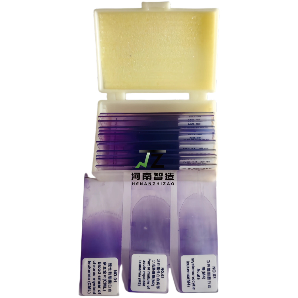 15-Piece Hematology Blood Smear Prepared Microscope Slides Set for Education Comprehensive set of 15 hematology blood smear prepared microscope slides for educational purposes, ideal for UK schools and universities teaching biology and life sciences. Comprehensive set of 15 hematology blood smear prepared microscope slides for educational purposes, ideal for UK schools and universities teaching biology and life sciences. 15-Piece Hematology Blood Smear Prepared Microscope Slides Set for Education - Image 2
