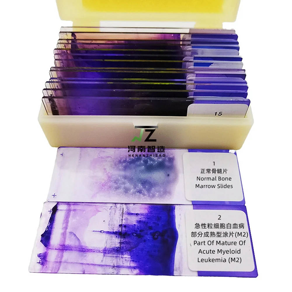 15-Piece Hematology Blood Smear Prepared Microscope Slides Set for Education Comprehensive set of 15 hematology blood smear prepared microscope slides for educational purposes, ideal for UK schools and universities teaching biology and life sciences. Comprehensive set of 15 hematology blood smear prepared microscope slides for educational purposes, ideal for UK schools and universities teaching biology and life sciences. 15-Piece Hematology Blood Smear Prepared Microscope Slides Set for Education - Image 5