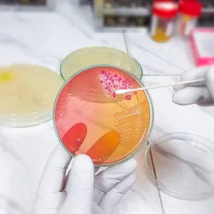 20 Pcs 7cm Nutrient Agar Plates