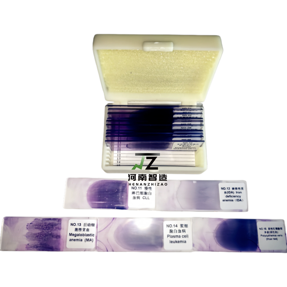 15-Piece Hematology Blood Smear Prepared Microscope Slides Set for Education Comprehensive set of 15 hematology blood smear prepared microscope slides for educational purposes, ideal for UK schools and universities teaching biology and life sciences. Comprehensive set of 15 hematology blood smear prepared microscope slides for educational purposes, ideal for UK schools and universities teaching biology and life sciences. 15-Piece Hematology Blood Smear Prepared Microscope Slides Set for Education - Image 3