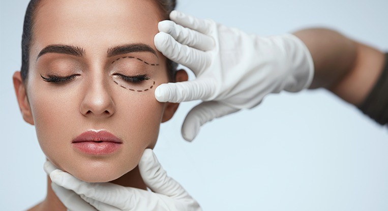 Blefaroplastia