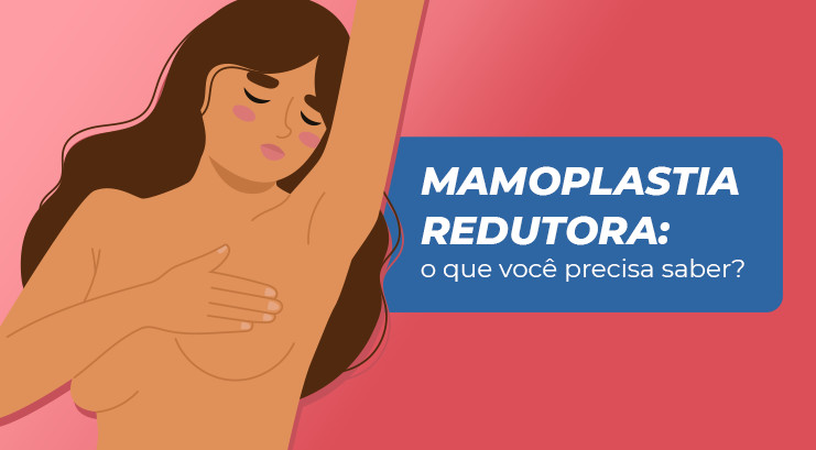 Mamoplastia redutora: o que você precisa saber - Dr. Daniel Rufatto