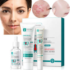 Herbal Acne Removal Face Cream Anti-Acne Gel Pore Shrink Serum Amino Acid Facial Cleanser Treatment Acne Mark Facial Care Set