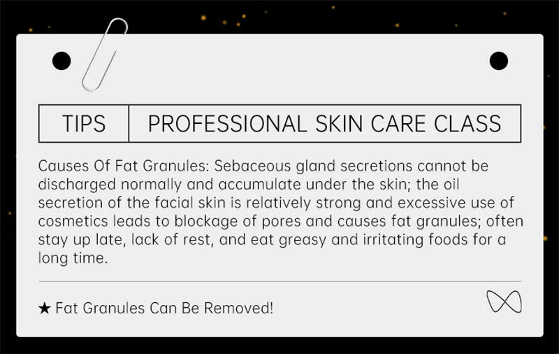 Description Picture 2 of itemRemoval Fat Particles Eye Mask Remove Eye Bags Dark Circles Fade Fine Lines Anti Aging Moisturizing Beauty Eye Care Products 15g