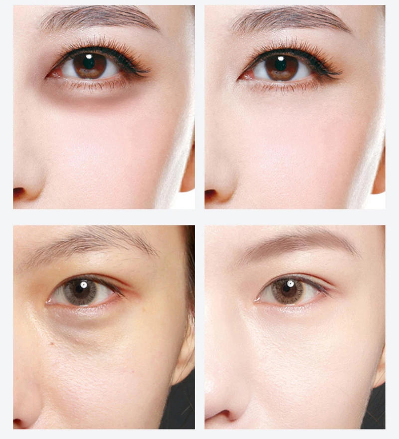 Description Picture 6 of itemCollagen Moisturizing Eye Mask Dilution Dark Circle Eye Patches Anti-Aging Anti-Wrinkles Skin Care Sets Korean Cosmetics