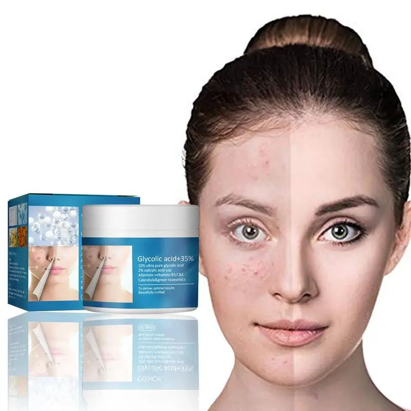 Glycolic acid + 30% acne removing