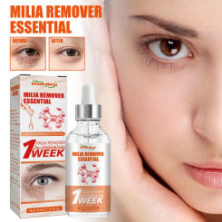 30ml Milia Remover Essential Remove Fat Particles Dark Circles Reduce Edema Eye Bags Fade Fine Lines Firming Lifting Eye Serum