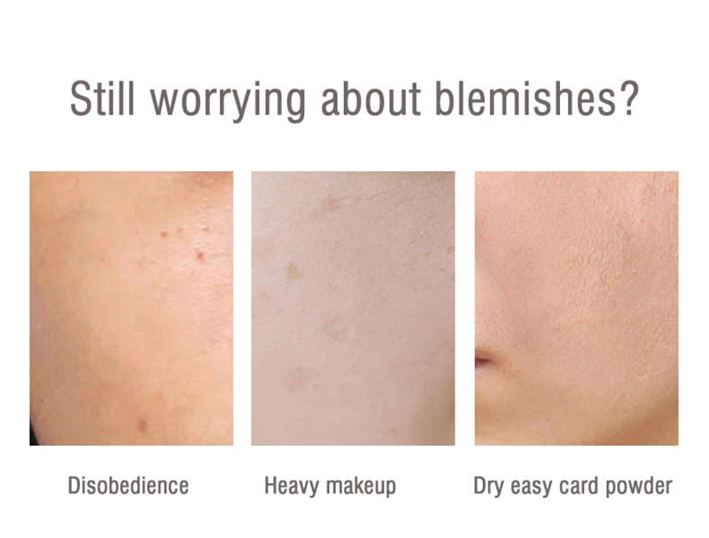 Description Picture 3 of itemBlemish Cover Foundation Cream Dark Circles Spot Acne Print Cover Waterproof Lasting Deep Skin Tone Moisturizing Facial Makeup