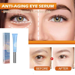 Electric Massage Eye Cream, A Late-night Savior, Improves Fine Lines And Dark Circles Around The Eyes, Repairs And Fades Eye Bag