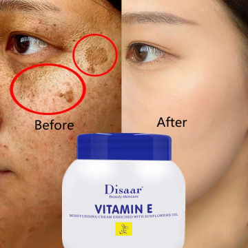 250ML whitening and freckle cream to remove Chloasma, acne, melanin and black spots to remove facial pigmentation moisturizing g