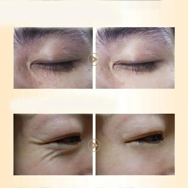 Description Picture 3 of itemHorse Oil Firming Eye Cream for Dark Circles&wrinkles& Fat Granule & Anti-aging Eye Essence Remove Dark Circles Eye Cream