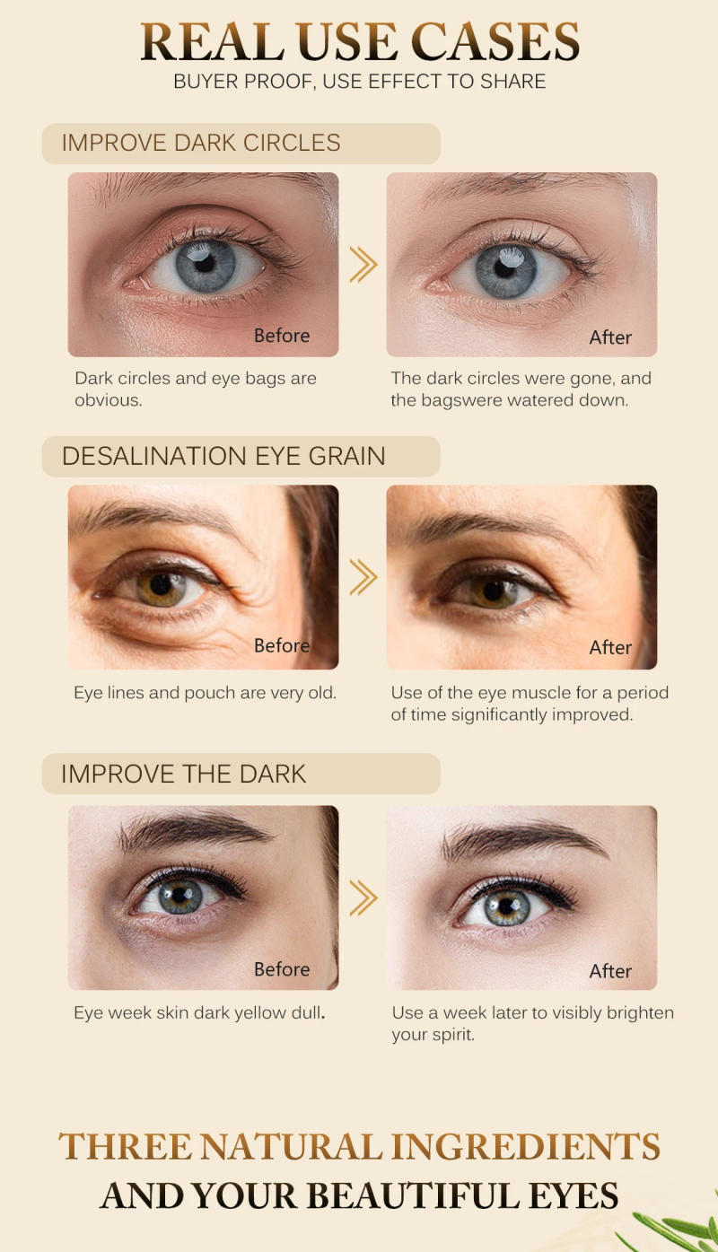 Description Picture 6 of itemAnti-Wrinkle Eye Serum Remove Eye Bags Remove Dark Circles Moisturizer Whitening Reduce Fine Lines Roller Massager Skin Care