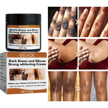 Fast Whitening Dark Knuckles Cream Pigmentation Correctors For Black Skin Hand Knuckle Elbows Knee Intense Stains Remover Cream