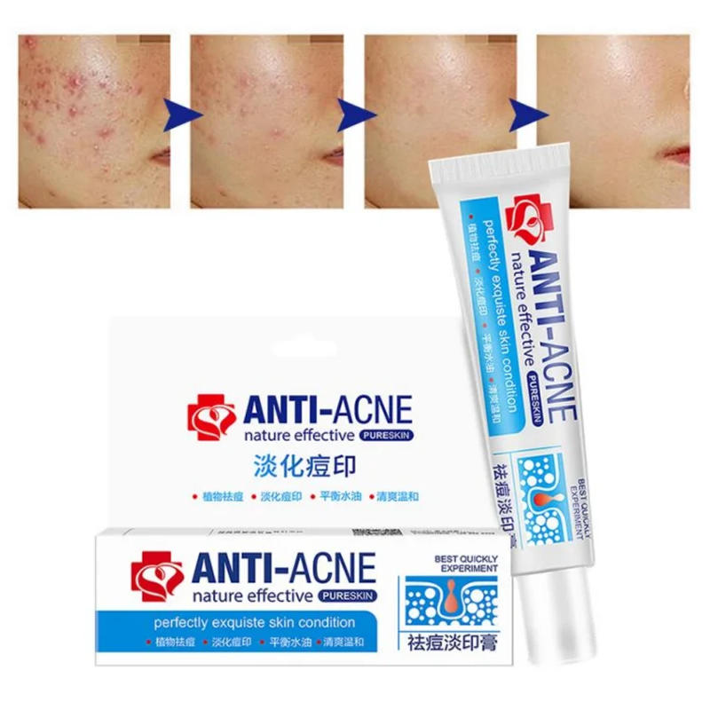 Description Picture 3 of itemNew Effective Acne Removal Cream Clears Blemish Pimple Remover Spot Safe Gentle Remove Acne Acne Cream For Clearing Severe Acne