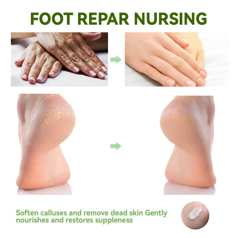 Description Picture 5 of itemHerbal Anti Crack Foot Cream Heel Cracked Repair Moisture Hand Mask Smooth Removal Dead Skin Callus Anti-Drying Feet Skin Care