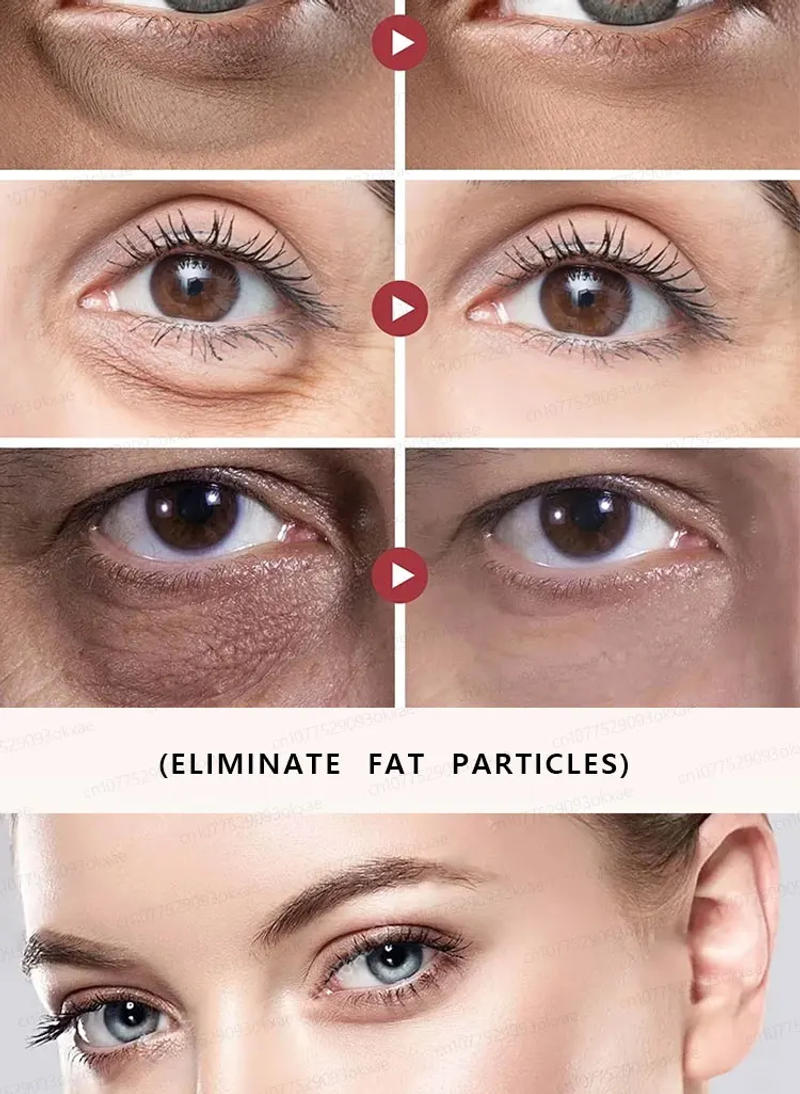 Description Picture 5 of itemEye Cream Removes eye bags, eliminates eye puffiness and dark circles