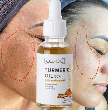 Turmeric Freckle Whitening Serum Curcumin Oil Brighten Fade Dark Spot Removal Pigment Melanin Correcting Beauty Face Skin Care