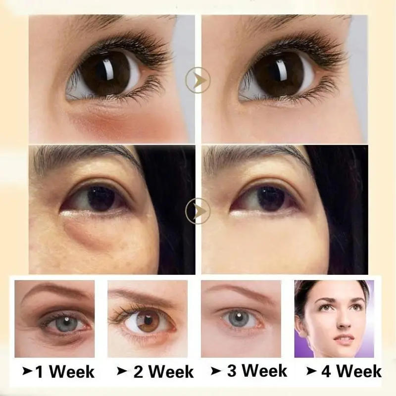 Description Picture 2 of itemHorse Oil Firming Eye Cream for Dark Circles&wrinkles& Fat Granule & Anti-aging Eye Essence Remove Dark Circles Eye Cream