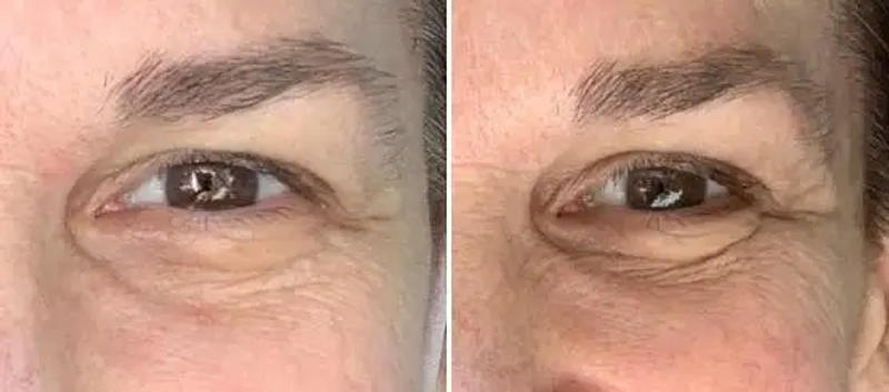 Description Picture 3 of itemFacial Lifting and Firming High-Protein Collagen Film Water-Soluble Mask Fades Dark Circles Eye Bags Eye Mask Light Fine Lines