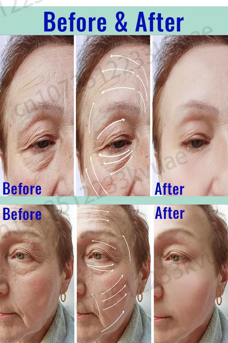 Description Picture 5 of itemEffective Anti-Ageing And Anti-Wrinkle Facial Serum To Remove Facial Wrinkles Fine Lines Around The Eyes Crow's Feet Neck Wrinkl