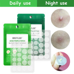 0.1mm Invisibal Natural Tea Tree Acne Pimple Patch Stickers Waterproof Day and Night Use Blemish Spot Facial Mask Dropshipping