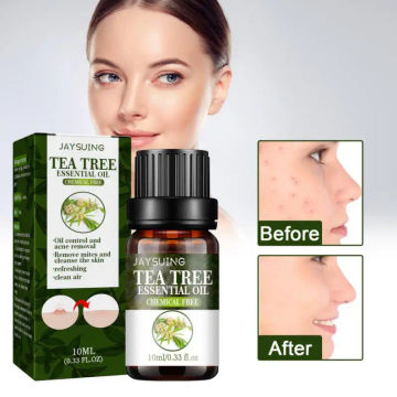 10ML Tea Tree Essential Oil Remove Pore Moisturizing Oil-control Face Serum Essential Oil for Aromatherapy Diffuser Skin Care