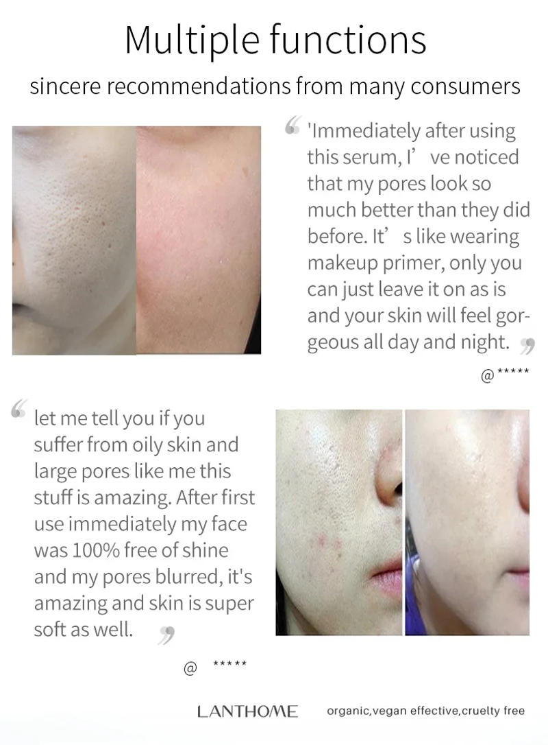 Description Picture 6 of itemPore Shrinking Skin Care Facial Essence Large Pore Remover Relieving Moisturize Face Oil Control Firming Serum Korean Cosmetics