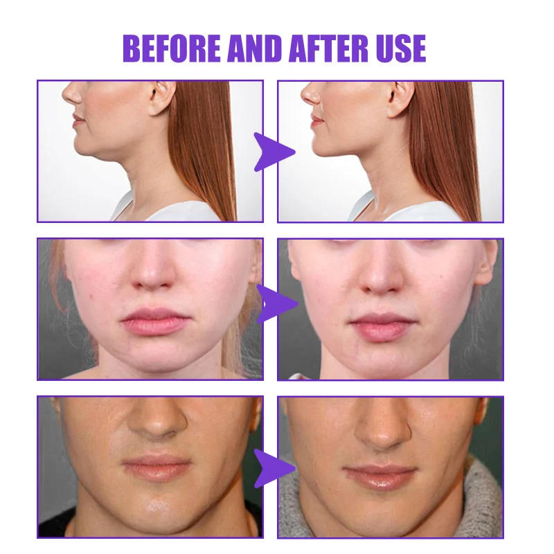 Description Picture 5 of itemEffective Face V Shape Lift Cream Remove Double Chin Slimming Firm Contouring Massage Cream Face Fat Burn Anti Aging Beauty Skin