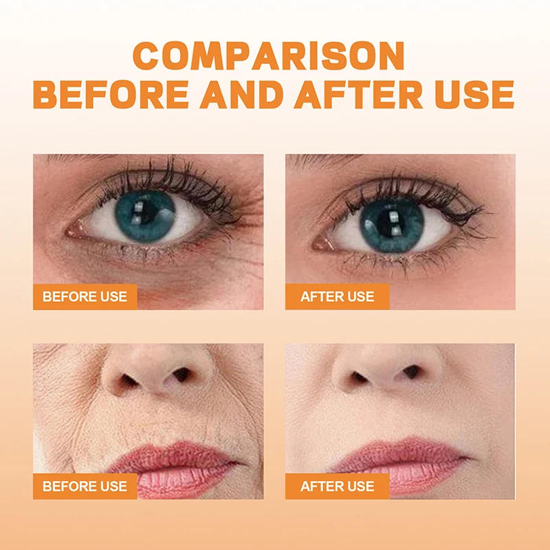 Description Picture 4 of itemFacial High-Protein Collagen Film Water-Soluble Mask Fades Dark Circles Eye Bags Eye Mask Light Fine Lines Lifting and Firming