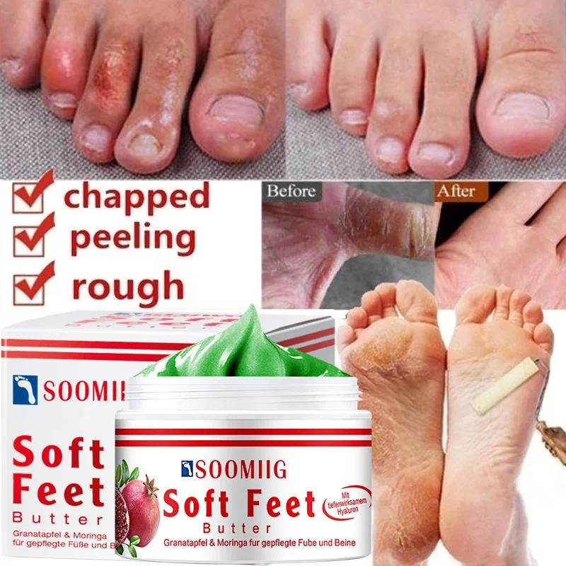 Description Picture 6 of itemAntifreeze Foot Cream Moisturizing Moisturizing Repair Dry Cracked Hands Anti-peeling Chapped Hand and Foot Care Products
