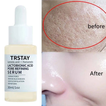 Lactobionic Acid Serum Shrink Pores Moisturizing Essence Liquid Facial  Purify Pore Treatment Beauty whitening cream Skin Care