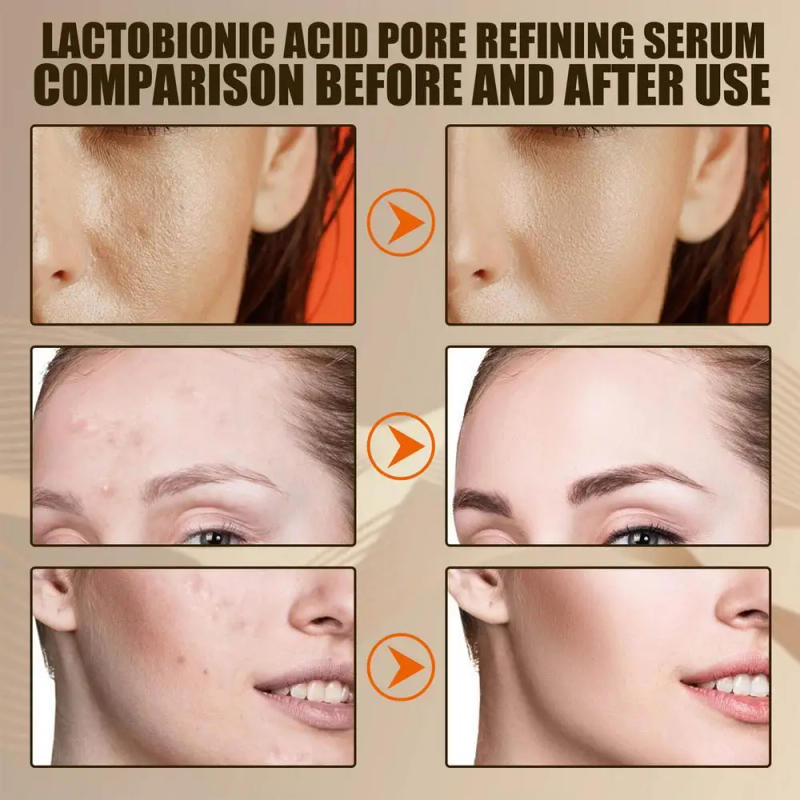 Description Picture 5 of itemLactobionic Acid Serum Instant Perfection Serums Shrink Pores Moisturizing Essence Liquid Anti Aging Face Fine Lines Skin Care