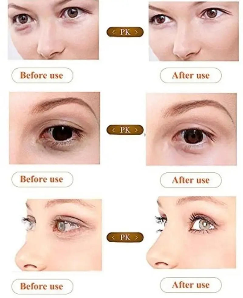 Description Picture 6 of itemHorse Oil Firming Eye Cream for Dark Circles&wrinkles& Fat Granule & Anti-aging Eye Essence Remove Dark Circles Eye Cream