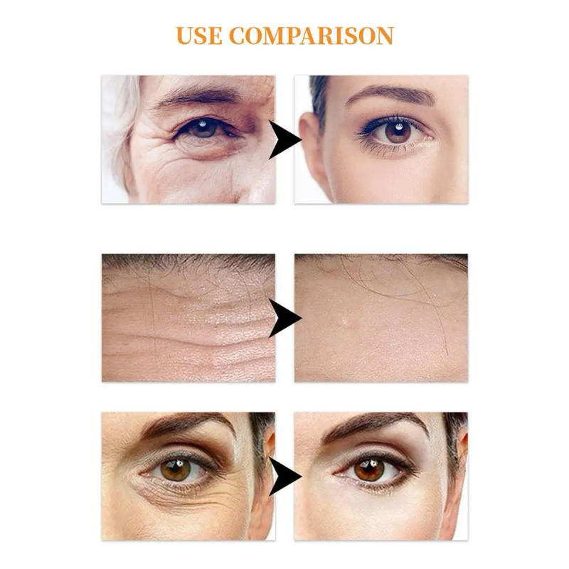 Description Picture 6 of itemHighprime Collagen Film 50Pcs Korea Collagen Soluble Patches and VC Mist Spray Anti Aging Eye Mask Wrinkles Remover Face Lifting