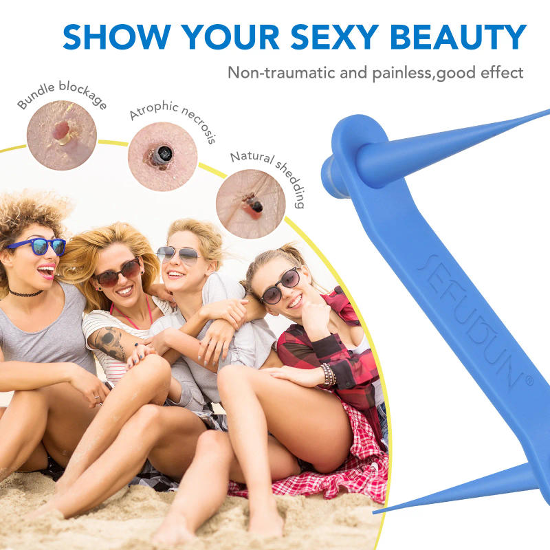 Description Picture 3 of itemSimple Wart Removal Tool Set Skin Tag Removeal Tool Easy To Clean Skin Care Tool Skin Tag Removal Skin Care Products