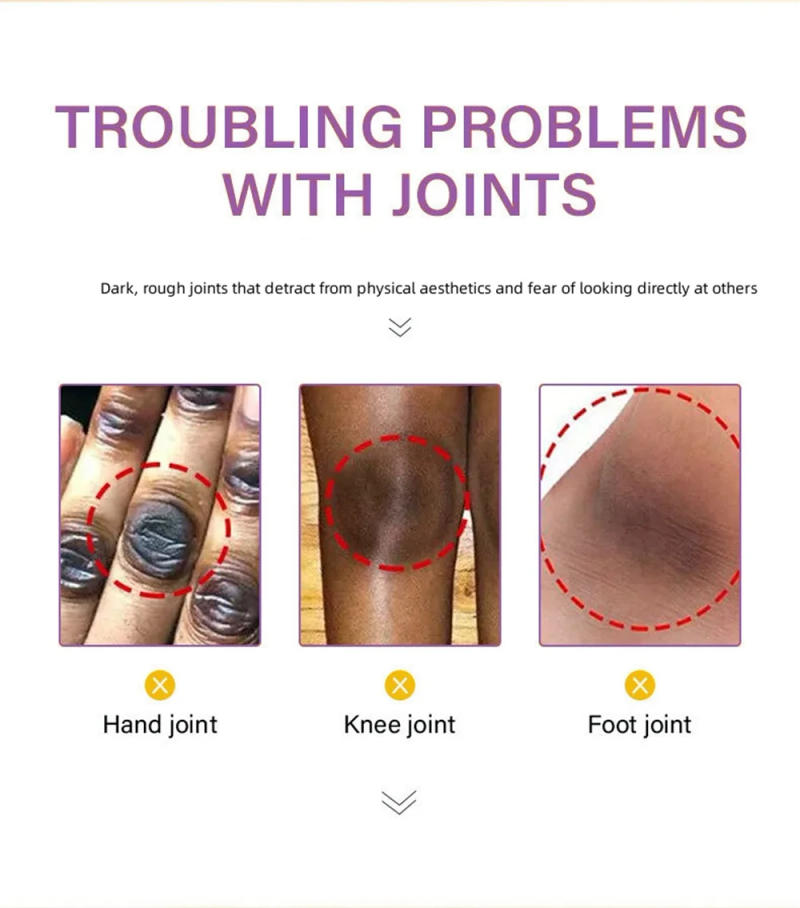 Description Picture 4 of itemDark Knuckles Fast Whitening Serum Pigmentation Correctors for Black Skin Hand Knuckle Elbows Knee Intense Stains Remover Serum