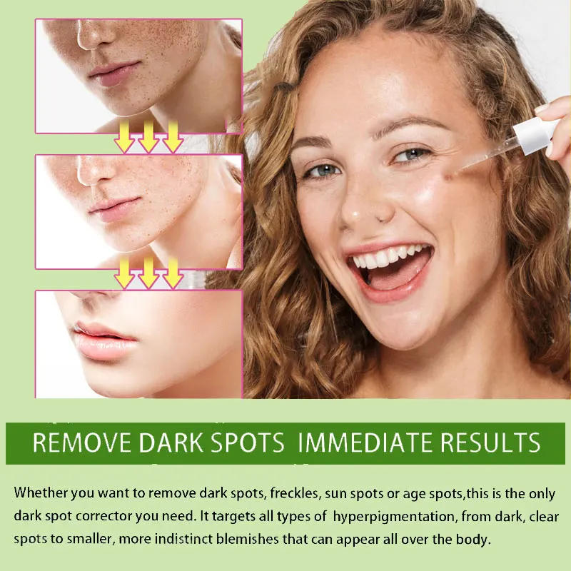 Description Picture 3 of itemFreckles Removal Essence Remove Facial Spots Skin Dark Spot Remove Melasma Spots Sunspots Whitening And Freckle Removing oil