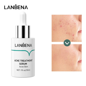 LANBENA Oligopeptide Anti Acne Solution Acne Treatment Serum Reduce Mark Shrink Pores Deep Repair  Plant Extracts Skin Care 30ML