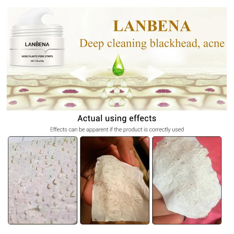 Description Picture 6 of itemLANBENA Pore Cleaner Nose Peel Blackhead Remover Face Deep T Zone Acne Pimple Removal Facial Diamond Beauty Care SPA Skin Cream