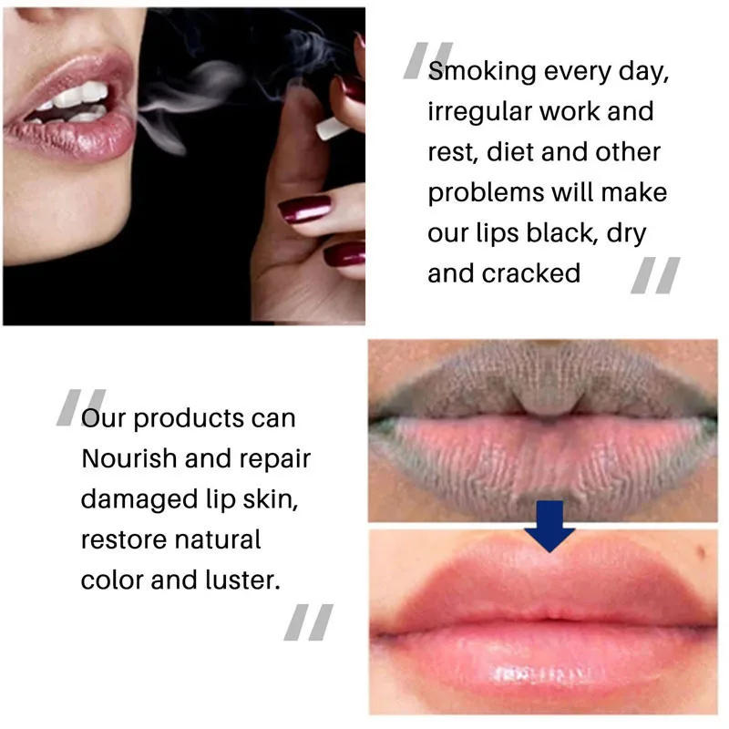 Description Picture 5 of itemRemove Dark Lip Balm Hyaluronic Acid Whitening Moisturizing Cream Exfoliating Dead Skin Lightening Pigment Care Beauty Health