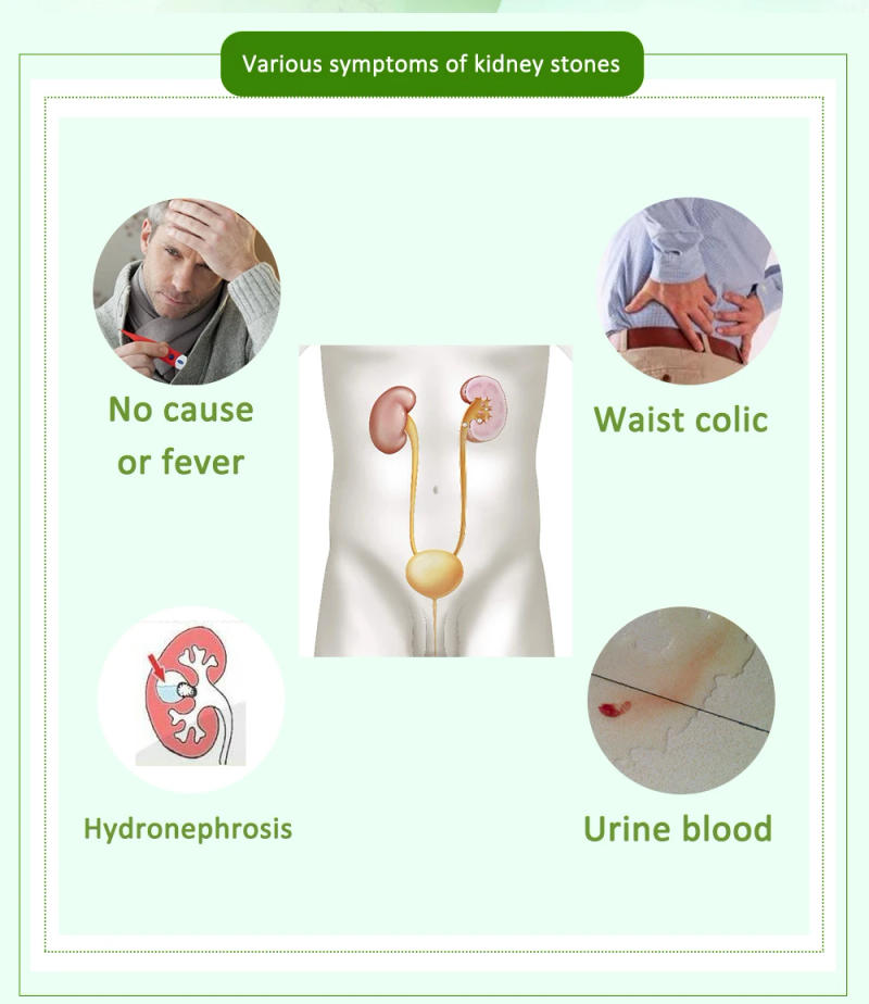 Description Picture 4 of item40 pcs/2 Packs Chinese medicine Care treatment Prevent Diuretic anti-inflammatory analgesic Kidney Stones Cleaning Teabags