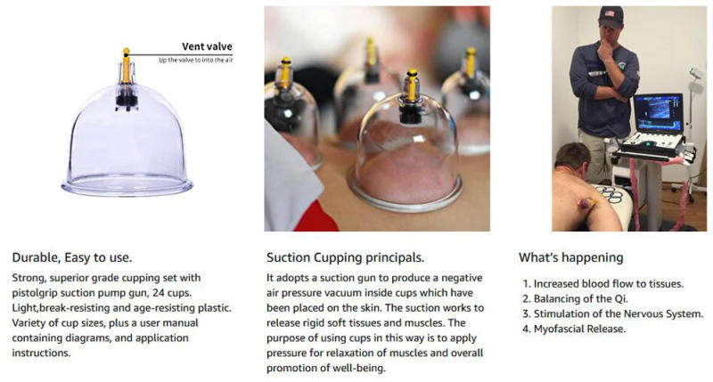 Description Picture 4 of itemCupping Therapy Sets,Hijama Cupping Vacuum Suction 24 Cups Sets for Cellulite Cupping Massage Back Pain Relief,Chinese Cupping
