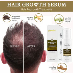 Hair Growth Products Regrowth Hair Essence Serum Spray 80ml Hair Loss Nourish Dense Tinning Hair Enhance Damged Hair Repair Care