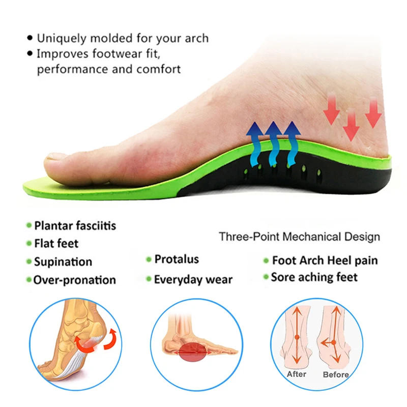 Description Picture 2 of itemEva Orthopedic Insole Unisex Outdoor Hiking Travel Essentials X/o Leg Correction Flat Arch Support Sports High Elastic Cushion